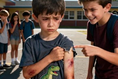 Bullied 8-Year-Old Called a Monster — The Shocking Truth About His Scars Left Parents in Tears…
