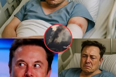 “BREAKING NEWS: Elon Musk Involved in HORRIFIC Accident — Severe Burns Leave the World in Shock!”